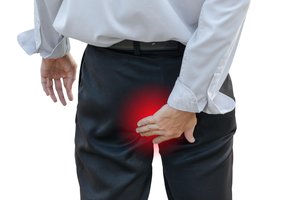 hemorrhoid