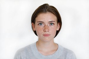 freckles on one's face