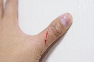 to scratch