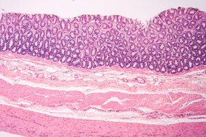 tissue