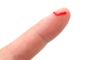 to bleed