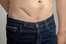 la apendicitis