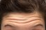 forehead