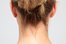 nape