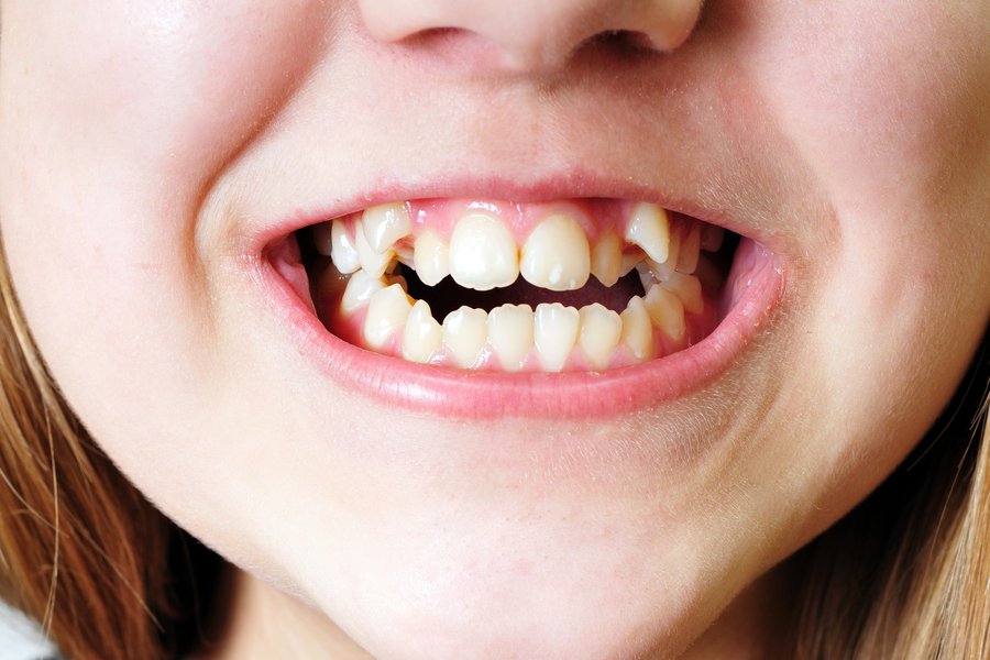 Chueeo en inglés Traductor de español a inglés