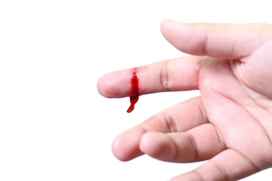 Bleedig Traductor de inglés a español